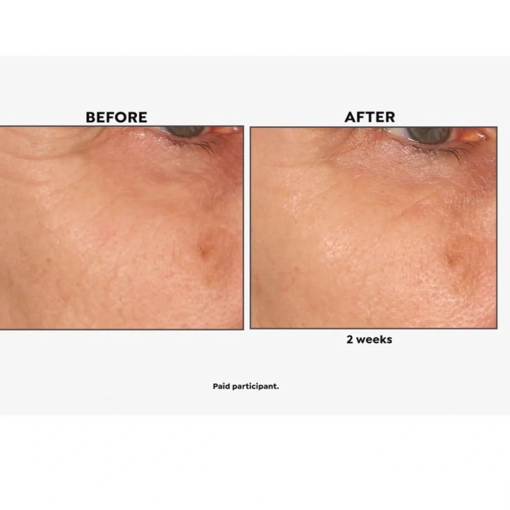 Perlier eye serum